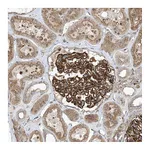 Atlas Antibodies Anti-OTOP1 Antibody