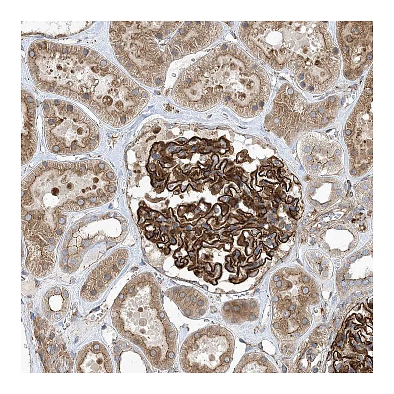 Atlas Antibodies Anti-OTOP1 Antibody