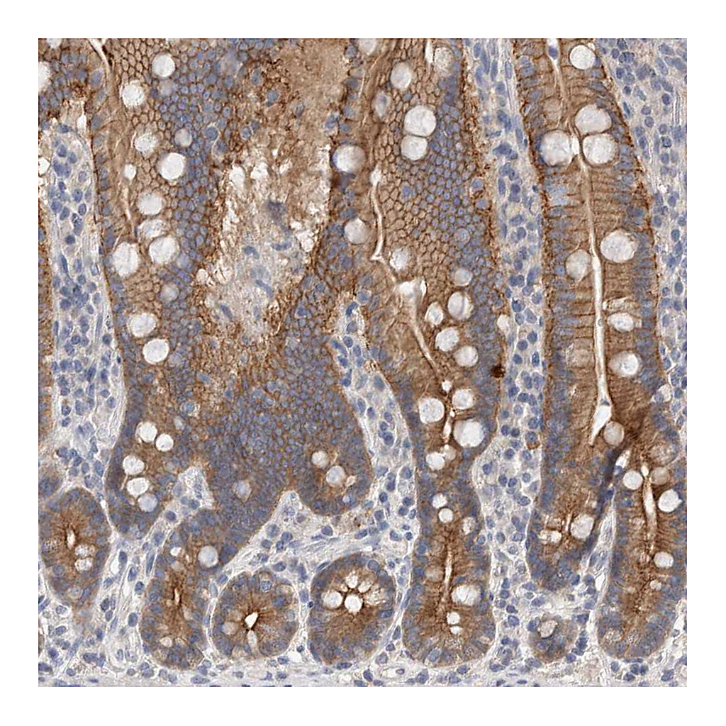 Atlas Antibodies Anti-OTOR Antibody