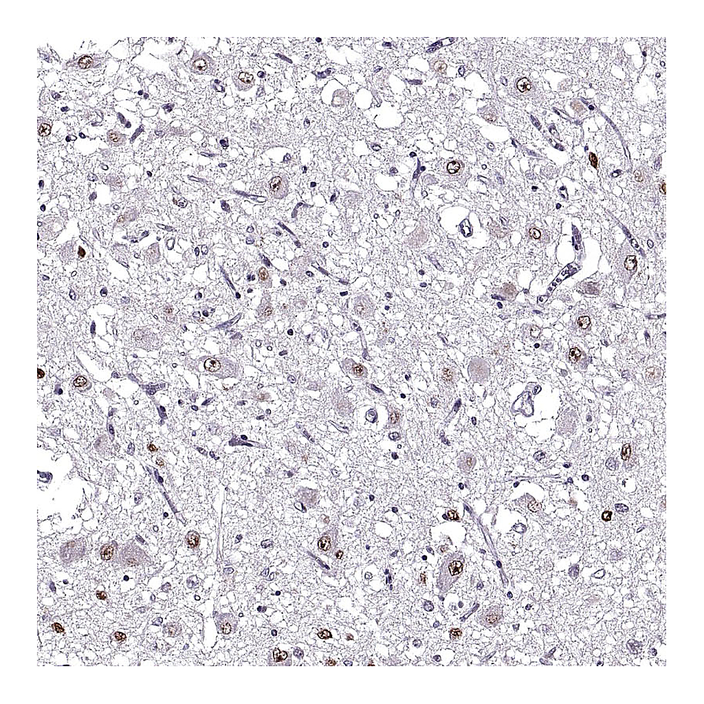 Atlas Antibodies Anti-OTP Antibody