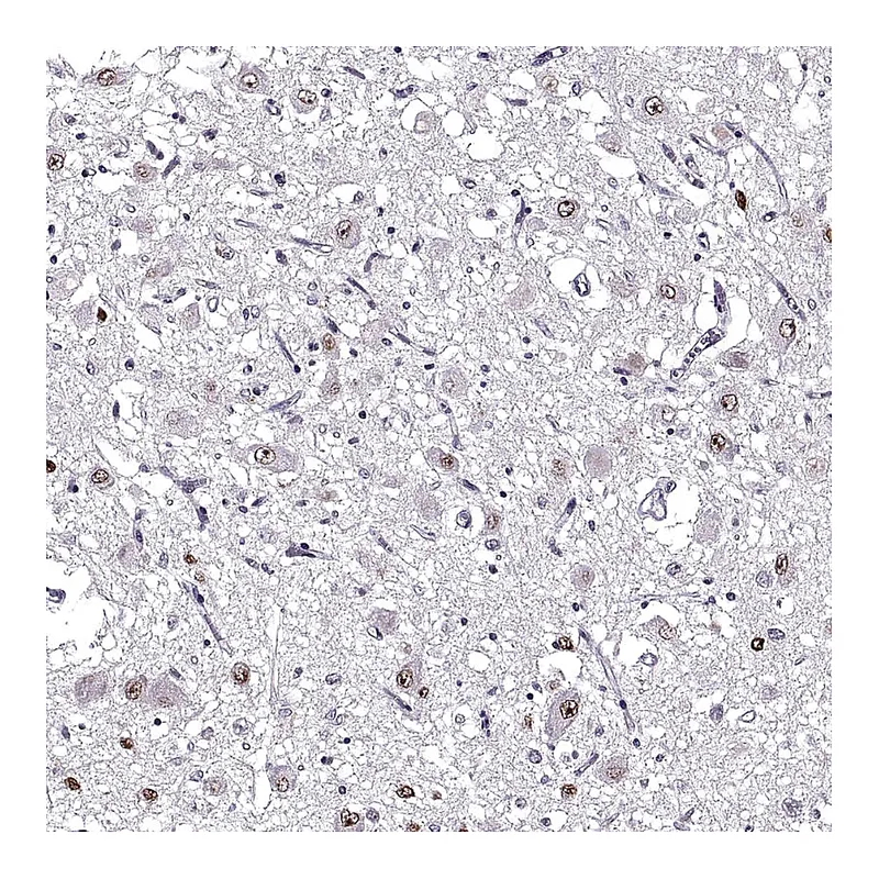 Atlas Antibodies Anti-OTP Antibody