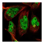 Atlas Antibodies Anti-OTUD1 Antibody