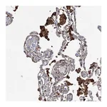 Atlas Antibodies Anti-OTUD1 Antibody