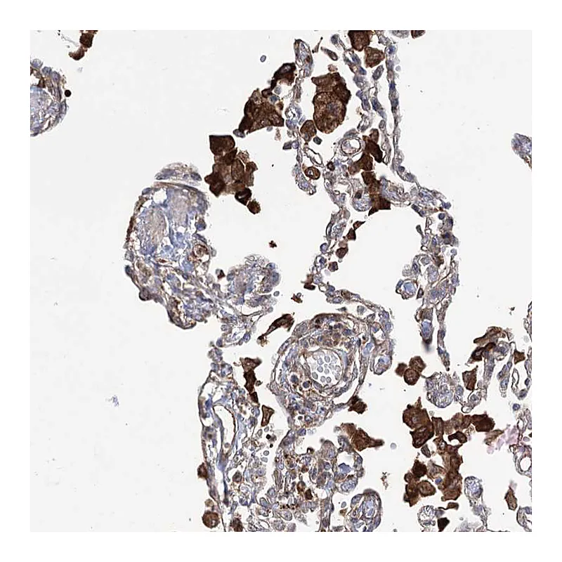 Atlas Antibodies Anti-OTUD1 Antibody