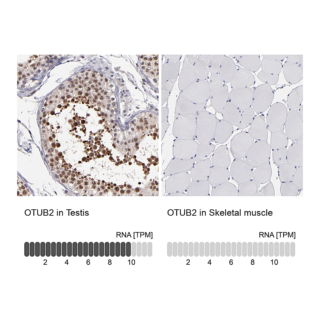 Atlas Antibodies Anti-OTUB2 Antibody