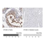Atlas Antibodies Anti-OTUB2 Antibody