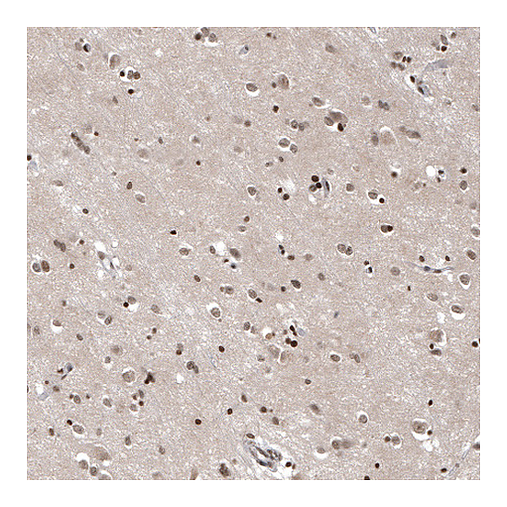Atlas Antibodies Anti-OTUB1 Antibody