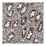 Atlas Antibodies Anti-OTUD5 Antibody