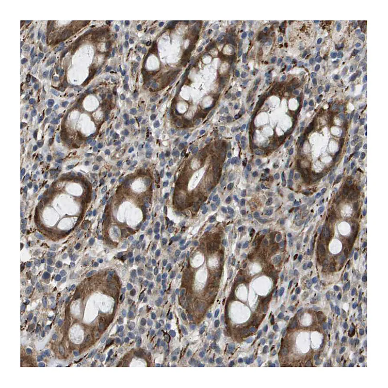 Atlas Antibodies Anti-OTUD5 Antibody