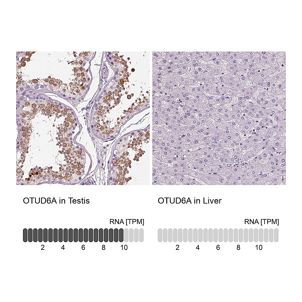 Atlas Antibodies Anti-OTUD6A Antibody