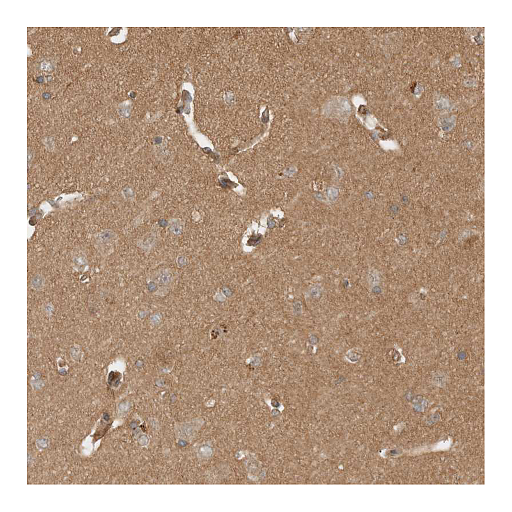 Atlas Antibodies Anti-OTUD6B Antibody