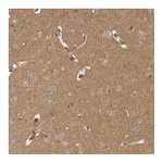 Atlas Antibodies Anti-OTUD6B Antibody