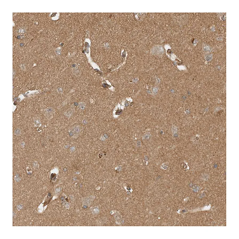 Atlas Antibodies Anti-OTUD6B Antibody