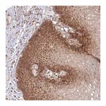 Atlas Antibodies Anti-OTUD4 Antibody
