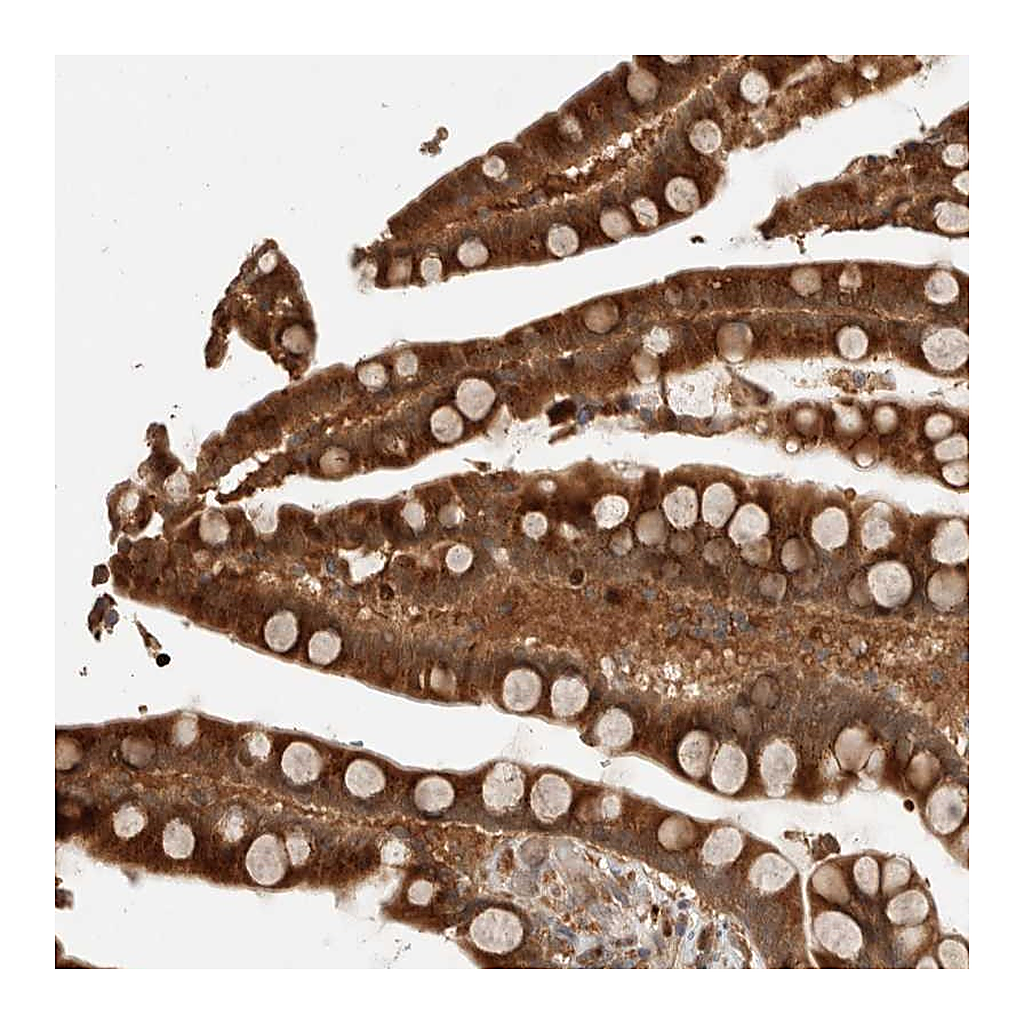 Atlas Antibodies Anti-OTUD6B Antibody