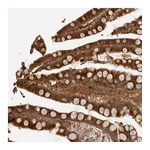 Atlas Antibodies Anti-OTUD6B Antibody