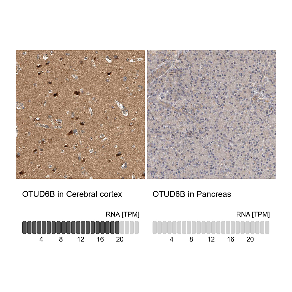 Atlas Antibodies Anti-OTUD6B Antibody