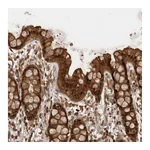 Atlas Antibodies Anti-OTUD7B Antibody
