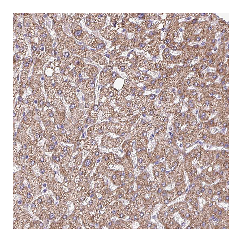 Atlas Antibodies Anti-OTULIN Antibody
