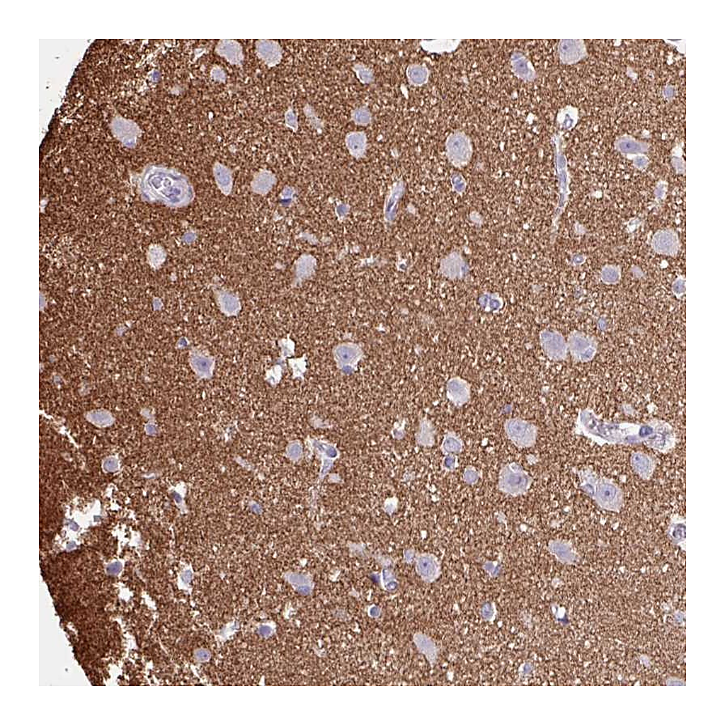 Atlas Antibodies Anti-OTX1 Antibody