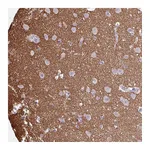 Atlas Antibodies Anti-OTX1 Antibody