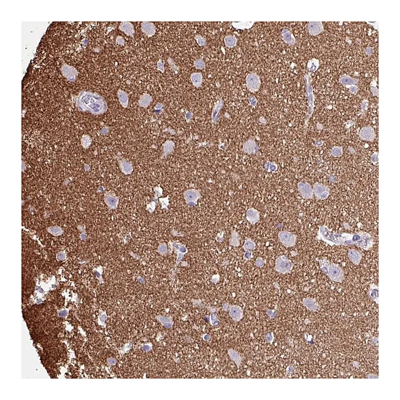 Atlas Antibodies Anti-OTX1 Antibody