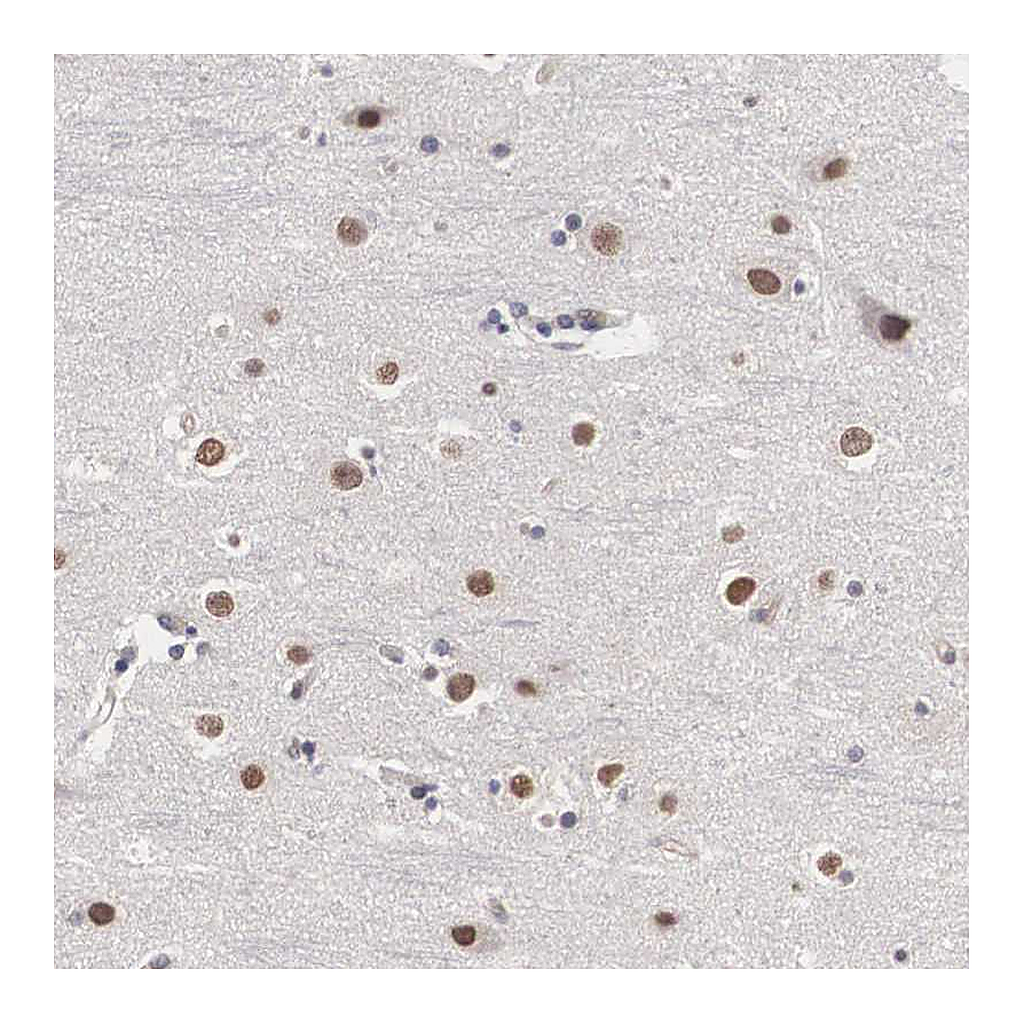 Atlas Antibodies Anti-OTX2 Antibody