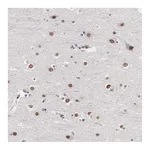 Atlas Antibodies Anti-OTX2 Antibody