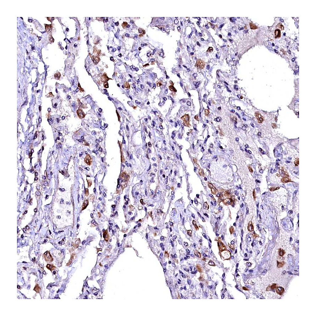 Atlas Antibodies Anti-OVCH1 Antibody
