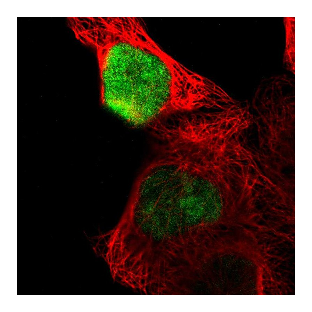 Atlas Antibodies Anti-OVOL1 Antibody