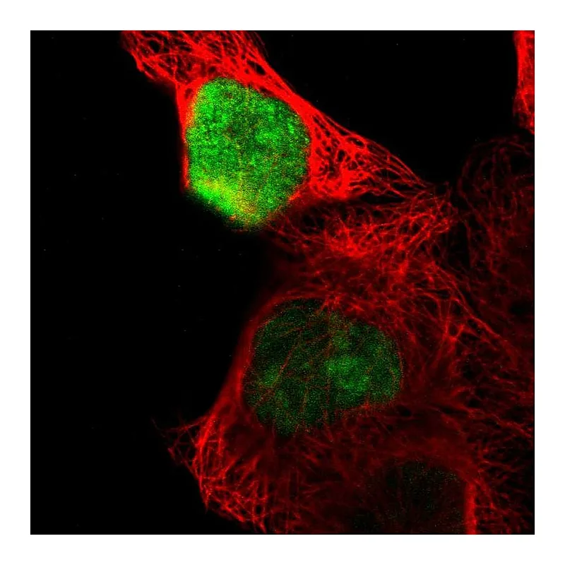 Atlas Antibodies Anti-OVOL1 Antibody