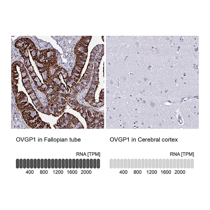 Atlas Antibodies Anti-OVGP1 Antibody