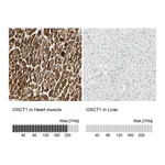 Atlas Antibodies Anti-OXCT1 Antibody