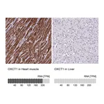 Atlas Antibodies Anti-OXCT1 Antibody