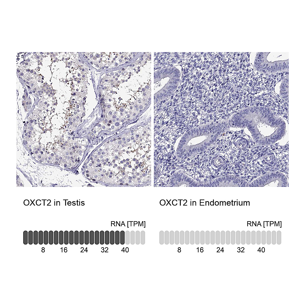 Atlas Antibodies Anti-OXCT2 Antibody