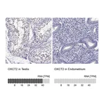 Atlas Antibodies Anti-OXCT2 Antibody