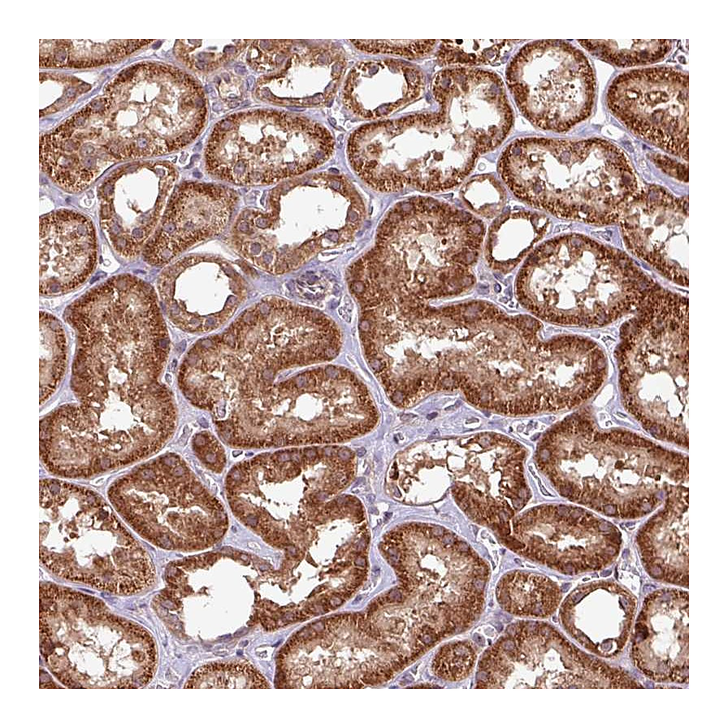 Atlas Antibodies Anti-OXER1 Antibody