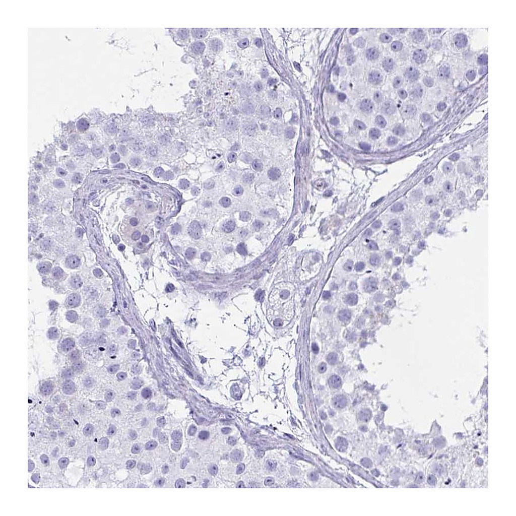 Atlas Antibodies Anti-OXLD1 Antibody