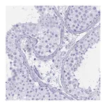 Atlas Antibodies Anti-OXLD1 Antibody