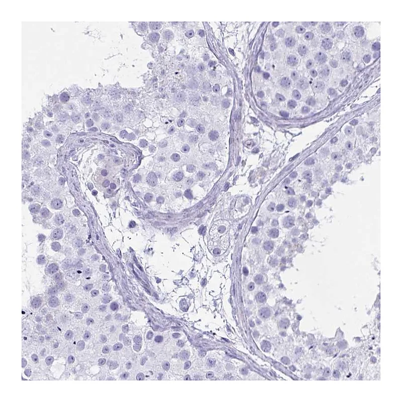 Atlas Antibodies Anti-OXLD1 Antibody