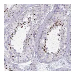 Atlas Antibodies Anti-OXLD1 Antibody