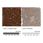 Atlas Antibodies Anti-OXR1 Antibody