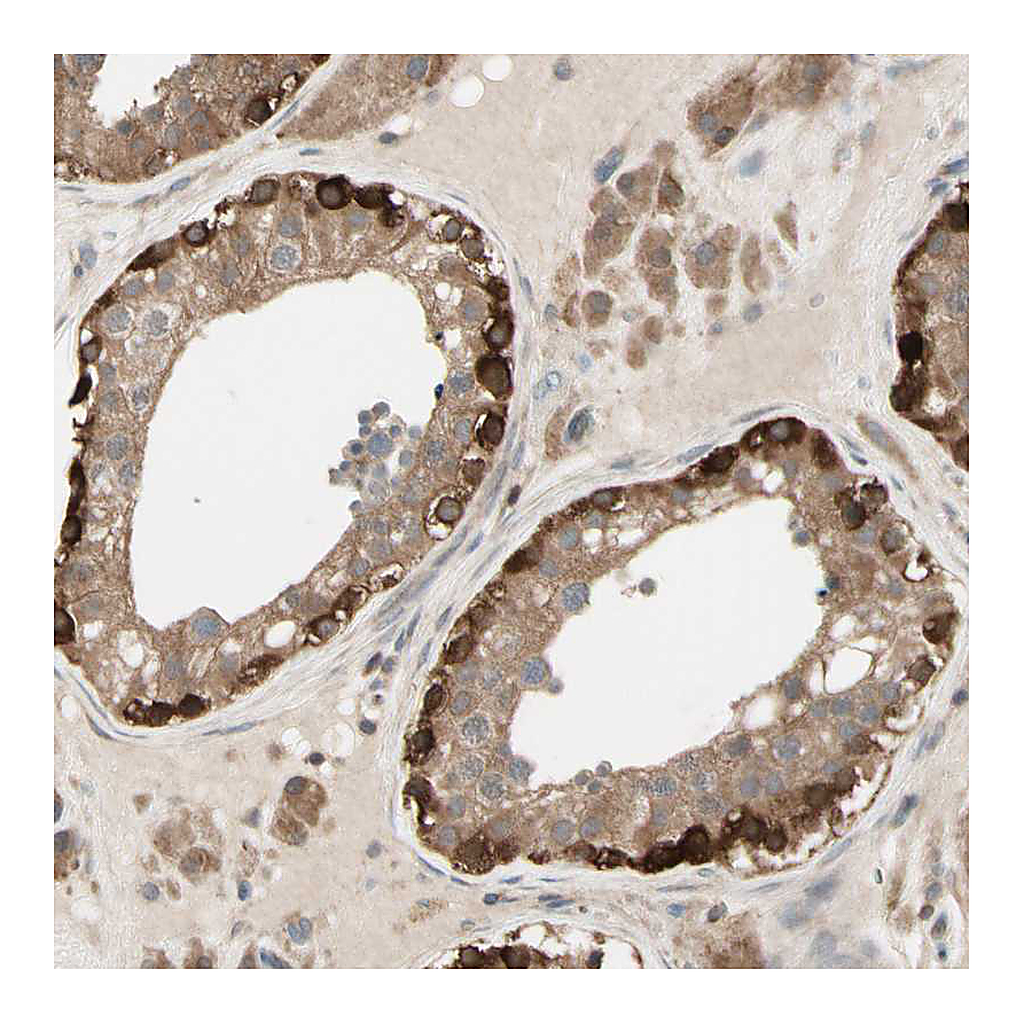 Atlas Antibodies Anti-OXSR1 Antibody