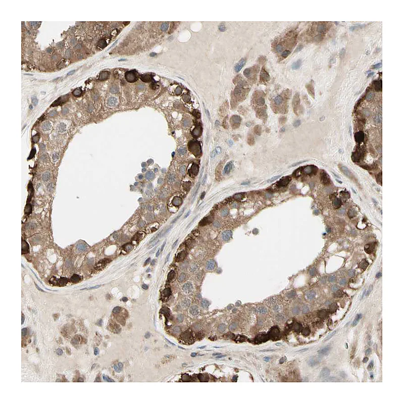 Atlas Antibodies Anti-OXSR1 Antibody