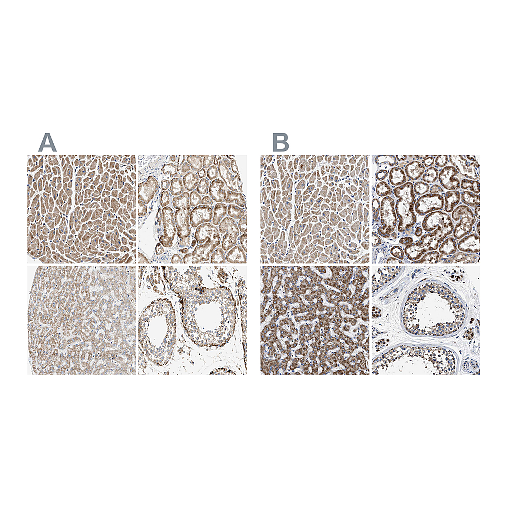 Atlas Antibodies Anti-OXSM Antibody