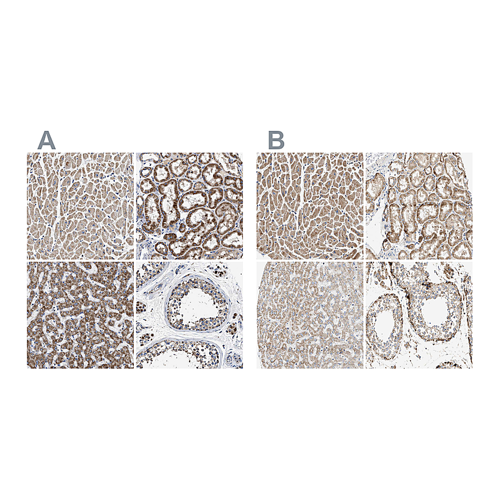 Atlas Antibodies Anti-OXSM Antibody