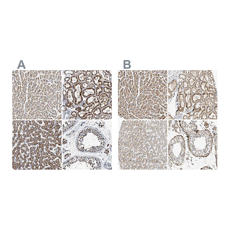 Atlas Antibodies Anti-OXSM Antibody