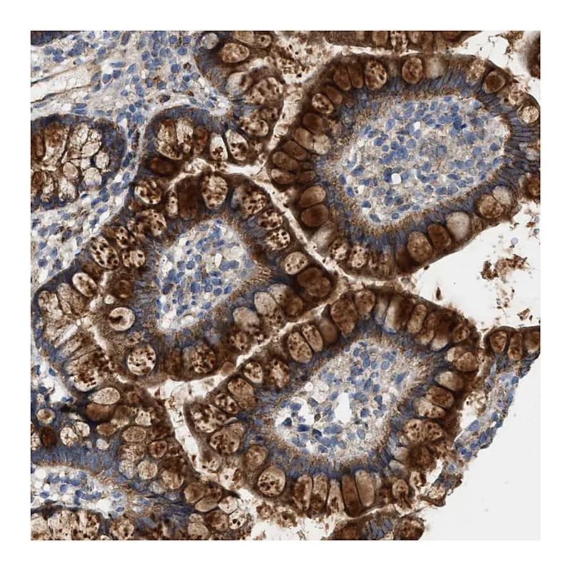 Atlas Antibodies Anti-OXSM Antibody