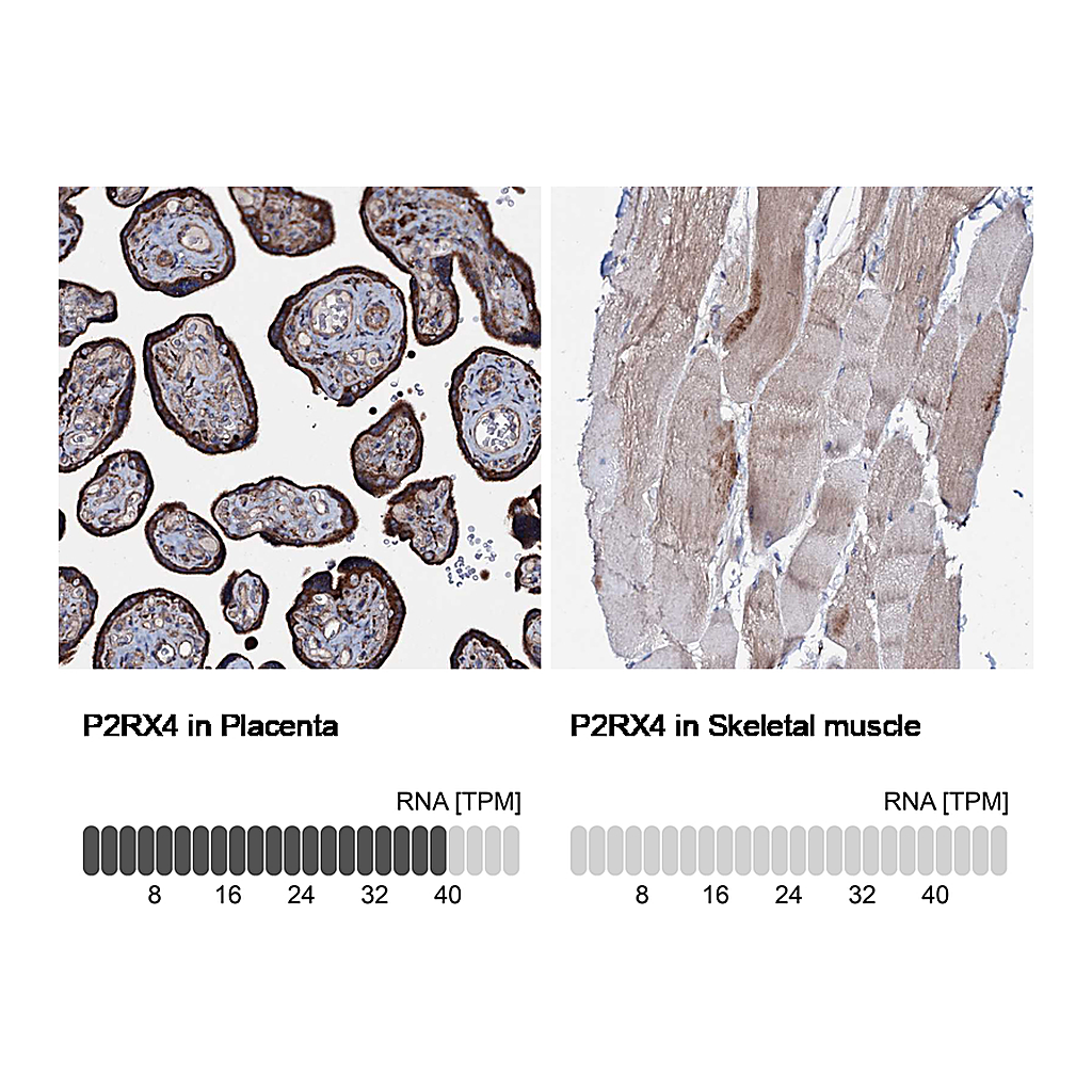 Atlas Antibodies Anti-P2RX4 Antibody
