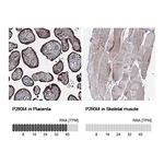 Atlas Antibodies Anti-P2RX4 Antibody